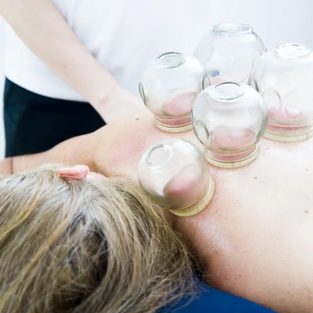 Fire cupping treatment — glass cups placed along a patient's neck and shoulder